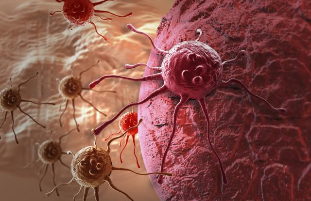 Otkriće lekara: Ovo uništava ćelije raka za 48 sati